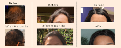 Onion Ginger Karanja Hair Oil