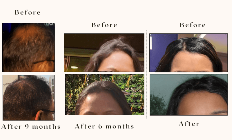 Onion Ginger Karanja Hair Oil