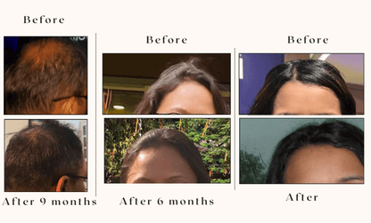 Onion Ginger Karanja Hair Oil